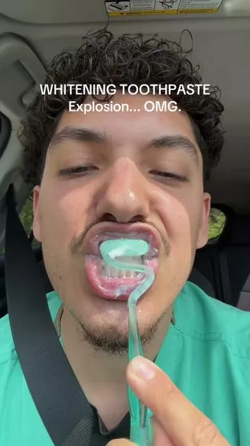 No way… this whitening toothpaste is crazy!! #teeth #teethwhitening 