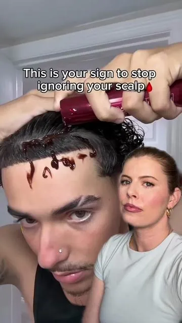 PSA: It is possible to treat hair loss at home!!  #AD I love how K Beauty always brings us science-backed protocols at affordable prices. This @VT Cosmetics US Reedle Shot Ampoule and Hair Brush Serum are on sale only here on TikTok shop, so stock up while you can!! #vtcosmeticspartner #ReedleShot #VTcosmetics #VThairgrowthshot 