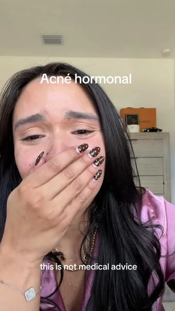 Éste es uno de mis favoritos porque lo uso una noche antes y en la mañana amanezco feliz con mi piel   ✨    #dryinglotionplus #SkinCare #drleo #acnehormonal #hormonalacne  States that the information is not guaranteed to be complete, accurate, or updated.
