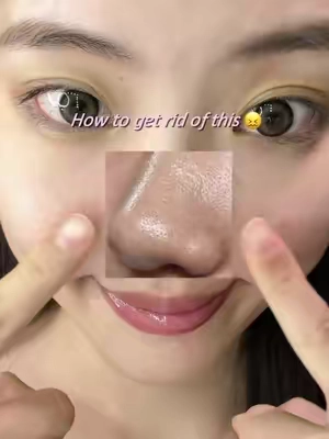 Don’t use pore strips, use THIS instead @Dr.Leo-USA #blackhead #claystick #oilyskin #skincareroutine #drleocleansingclaystick 