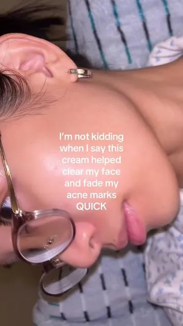 10/10 viral Korean moisturizer is actually worth the hype🫶🏻I'm literally on my 7th bottle wished I got my hands on it sooner😭 #dralthea #dralthea345cream #clearskin #acne #koreanskincare 