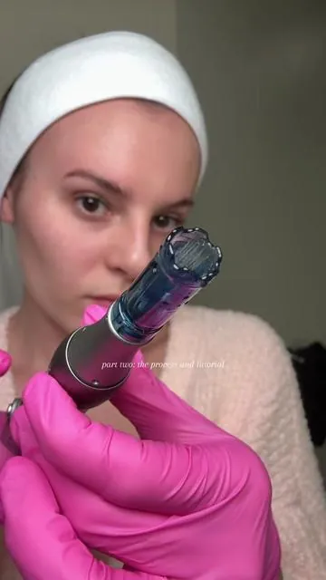 Microneedling at home full tutorial to save you so much money! #microneedling #microneedlingface #microneedlingathome #microneedlingtips #drpen 