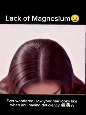 Lack of all these was cooking my hair  #dht #dhtblocker #hairloss 