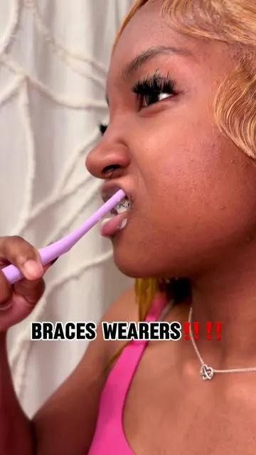 @bug 🌠 #daughter #braces 
