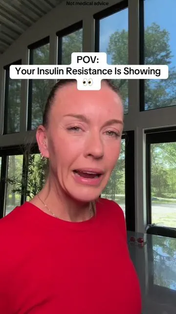 Prevention > Treatment. Don’t let dysregulated sugars and insulin steal your beauty. If you don’t want meds to be your future, you’ve got to get your sugars and insulin in check. #bloodsugar #skintags #holistichealth #naturalmedicine #diabetes As always discuss all health concerns/supplements with your doctor. 