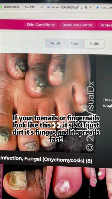 The transformation of my toenails has really begun!#tiktokshop #tiktok #tiktokshop