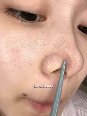 Watching my pores get clean is oddly satisfying! 🫧 #skincareroutine #clearskin #claystick #blackhead #drleohonestreview 