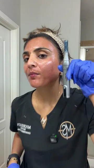 Microneedling at home- 101 by Esthetician 🌸✨ #microneedling #antiaging #stemcells #fyp #skincare 