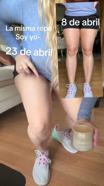 Describir como esto funcionó, es muy difícil lograr con palabras. Necesitas en verdad probar este producto y darte cuenta lo rápido que funciona. Celulitis? ¿Piel flácida? ¿Espejo que ya no te gusta cómo te devuelve la imagen? Yo también estuve ahí… hasta que probé Crup Tierno Firming Gold Gel. En menos de 15 días empecé a ver cambios reales. Mi piel más firme, más lisa, más uniforme… y lo mejor: me volví a sentir segura en mi propia piel. Esto no es magia… es constancia + el producto correcto. 💥 Textura ligera 💥 Absorción rápida 💥 Sensación reafirmante desde la primera aplicación Y ahorita lo tienen en solo $21 con envío gratis. No es un lujo… es una inversión en ti. 👉 Si estás cansada de esconderte, 👉 si quieres recuperar tu confianza, este es tu momento. * celulitis * piel de naranja * piel firme * reafirmante * tonificación * flacidez * piel lisa * piel uniforme * textura de la piel * cuidado corporal * anti celulitis * reducción de celulitis * tratamiento corporal Bajar de peso / Cuerpo: * bajar de peso * quemar grasa * moldear cuerpo * reducir medidas * abdomen plano * piernas firmes * glúteos firmes * cintura definida * transformación corporal * rutina de belleza Mujeres / Lifestyle: * mujeres reales * amor propio * autoestima femenina * confianza en ti misma * rutina diaria * cuidado personal * belleza femenina * mujeres ocupadas * mamás ocupadas * glow up * transformación * disciplina femenina