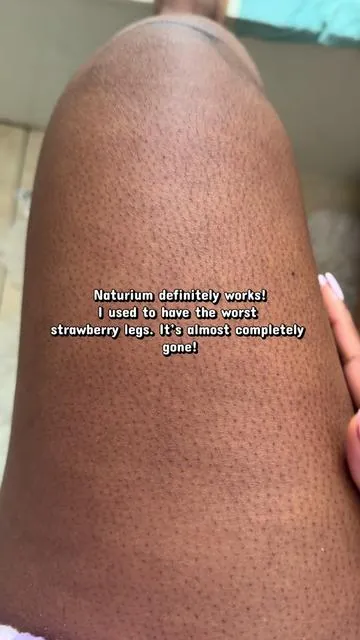 My skin is so soft afterwards  😍😍@Naturium #kp #strawberryleg #keratosispilaris #naturium #naturiumskincare 
