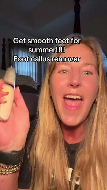 Foot callus remover. #tiktokshopjumpstartsale #callus #callusremoval #feet 