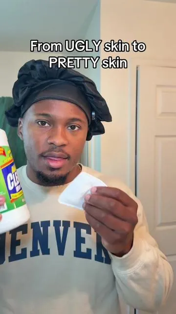For my people who have hyperpigmentation bad 