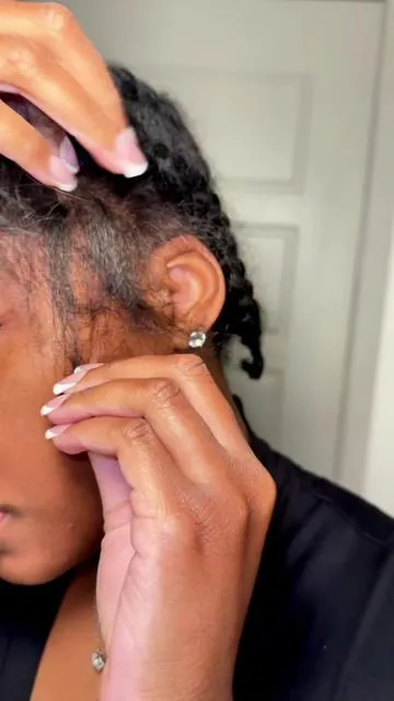 Half wigs bald spots can come easily if you wear them a lot! It happened to me😭😭 but I’ve been growing them back with this wig grip cap! It’s soooo much more comfortable and I can even sleep with them in because there are no combs on my head. #wiggripcap #halfwiginstall #tractionalopecia #halfwig #wigcap 