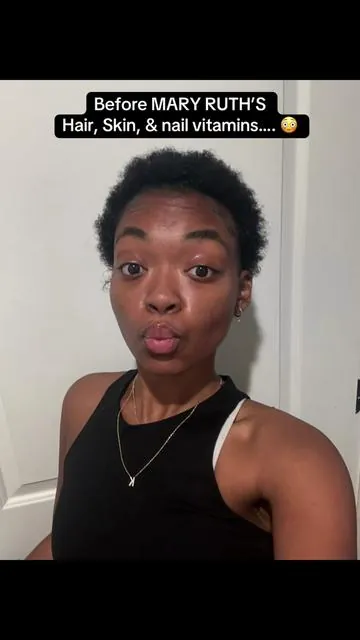 Big chopped a year ago 😮‍💨🔥 #maryruthsorganics #hairvitamins #hair 
