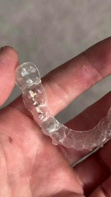 These tablets actually clean my retainers so well #retainercleaner #dentaltips #dentalhygienetips #teethcare 