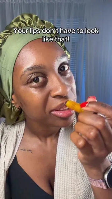 It works! #turmeric #darklipscorrection #darklips #lipbalms #lipcareproducts 