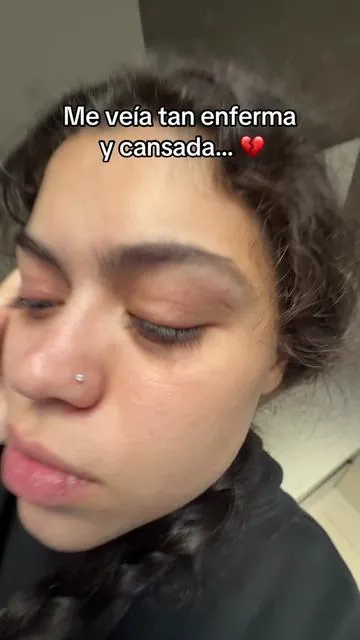 Gracias mamá!!! Por recomendarme esto ❤️‍🩹 #glowup #ojeras #rejuvenecimiento #antiedad 