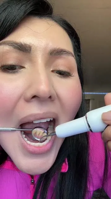 CURVY MOON Teeth Cleaner Kit electric toothbrush. ##tartarremover##toothcleaner##teethcare##rechargeable##curvymoon