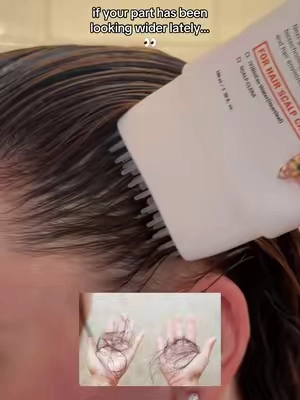 thank goodness I found the bundle 😭 #Lilyeve #HairGrowthJourney #HairTok #brushserum #koreanscalpcare @LILYEVE GLOBAL 