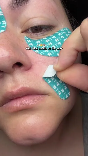 the results are WILLLDDD 🤯  #ptr #facetape #infusedfacetape #peterthomasroth #facetapeforwrinkles 
