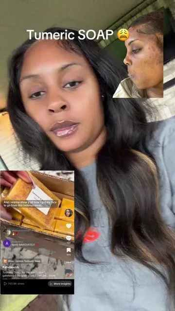 That Tumeric Soap Works ! Link is in my description #tumericsoap #skincare #skinroutine #kojicacidsoap #fyp 
