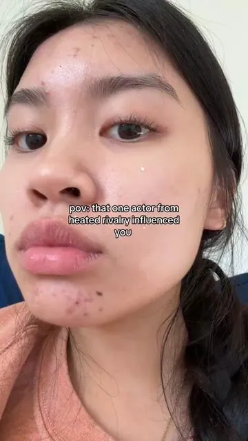 makes my skin SO soft #acne #heatedrivalry #hudsonwilliams #koreanskincare 