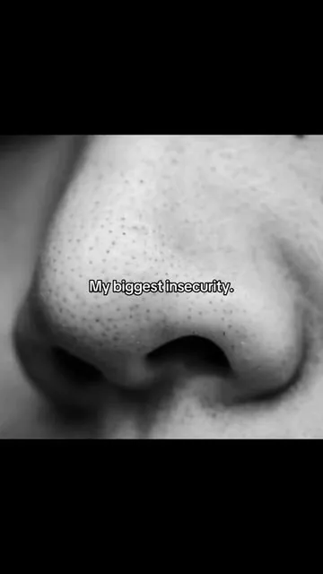 I used to hate when people would look at my nose