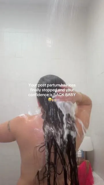 Postpartum hair loss absolutely humbled me 😭 I was losing HANDFULS of hair daily until I realized healthy hair starts with a healthy scalp. The LilyEve Grow Turn Ampoule + volumizing shampoo and conditioner have my hair looking fuller, healthier, softer, and my scalp feeling SO much calmer. The reviews on this bundle are insane for a reason 👏🏼 These are my opinions. Please check reviews, do your own research, and make informed decisions as results may vary!! I’m only sharing what I’ve found that has helped me tremendously. #postpartumhairloss #hairgrowthjourney #thinninghair #scalphealth #hairgrowth 