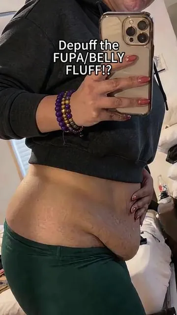 Free shipping now, get yours soon. #fupa #belly #massagetool #cellulite #tiktokmademebuyit 