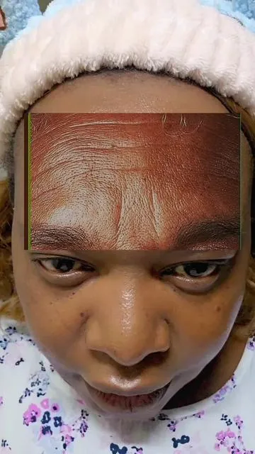 Anti-aging glassy skin #glassyskin  #koreanskincare #wrinklefree  #creatorsearchinsights 