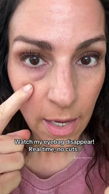 Eye bags & dark circles disappear in 60 seconds! #eyebag #undereyebag #darkcircles #antiaging #matureskin @Westmore Beauty 