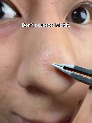 no more blackheads @ilso US #ilso #pores #sebumsoftener #koreanskincare #Summervibes 