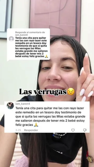 Respuesta a @iam_karen4 #verrugas #parati 