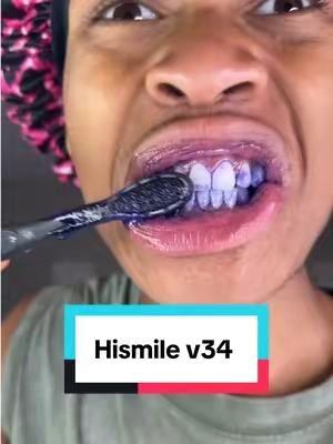 This stuff works for anyone🔥#whiteteeth #hismile #teethwhitening #yellowteeth #teethcare 