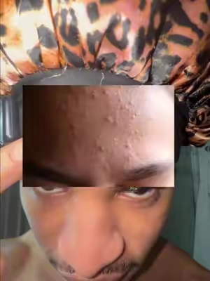 7641356013056150798
