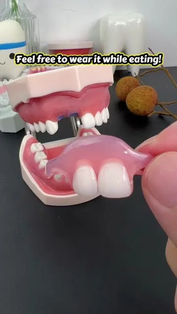 Feel free to wear it while eating!#smileseek #tooth #Dentures #faketeeth #partialdenture 