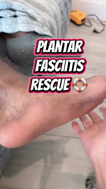 #plantarfasciitis rescue!