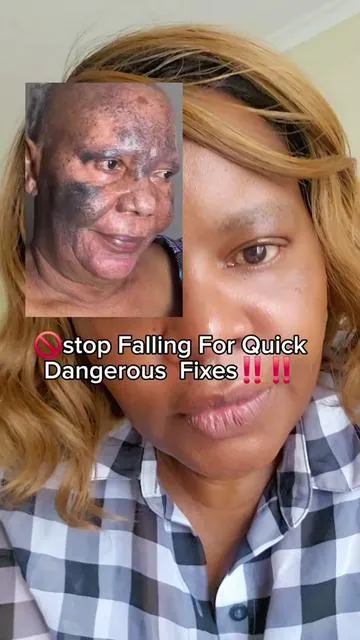 ⏩️Try this Secret to Youthful  looking #antiaging  #skincaresecrets  #youthfulskin #naturalbeauty  skin#creatorsearchinsights 