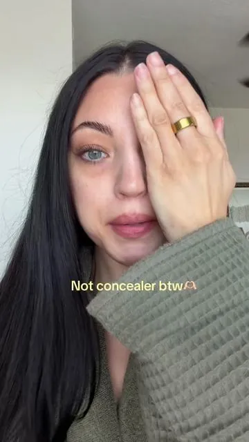 DARK CIRCLES GONE.  I can’t believe this is an eyecream and not makeup!! It’s THE best hack for dark circles. @Dr.Melaxin  #darkcircles #darkcirclestreatment #undereyecircles #drmelaxin #tiktokshopcreatorpicks 