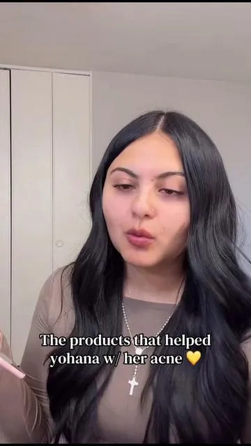💛💛 #fyp #acnetreatment #acne #skincare #yohanaortiz 