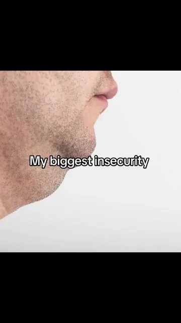 These are going viral #keto #fyp #viral #doublechin #insecurity 