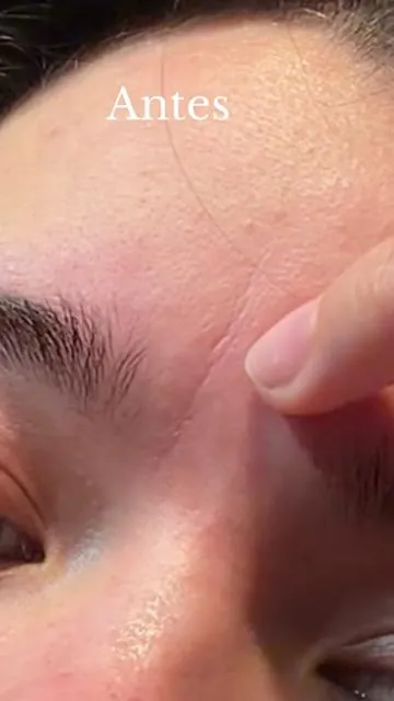 #celimax #skincare #retinal #fypシ゚viral 