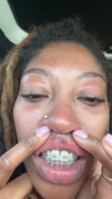 7643559871836687646