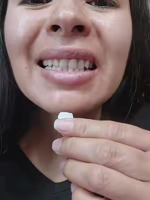 EELHOE Moldable Dental Gel como hacer el diente Moldeable paso a paso  Dentis #moldable #moldablefalseteeth #dientes #diente #eelhoe 