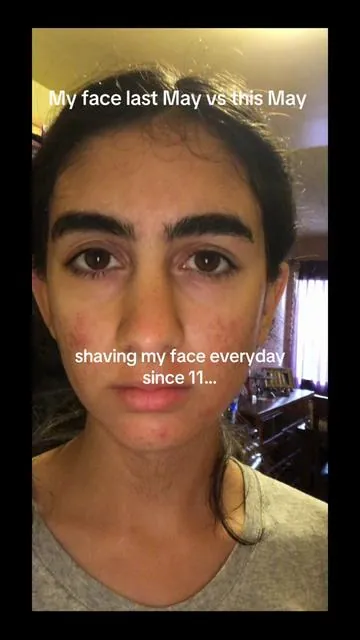 The difference in myself and especially my confidence is so telling… will NOT gatekeep this 