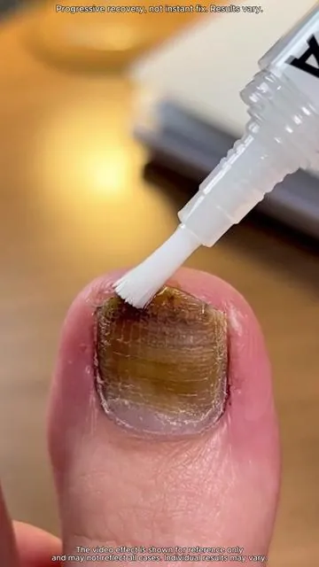 If your nails aren’t in good shape, do give this a try! #nailcare #toenails #nailtok #fyp
