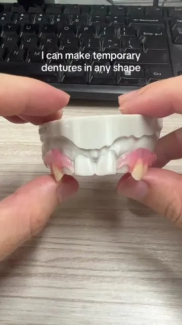 I can make temporary dentures in any shape#Dentures #smileseek #tooth #partialdenture #dealsforyoudays 