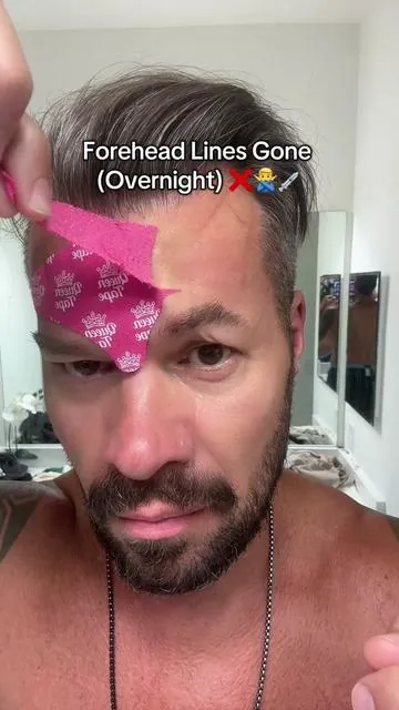 Hyaluronic acid & peptide infused forehead tape results. 