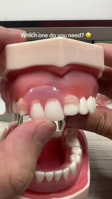 Which one do you need? 😀#Smileseek #dentures #faketeeth #dealsforyoudays #dealsforyoudays 
