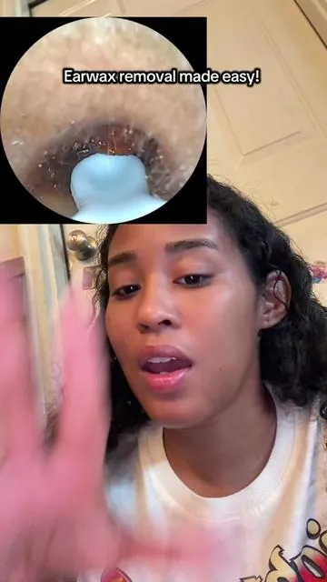 No more pushing the ear wax into the babies ears. You can see what your getting out and so can they. #earwax #earwaxremoval #earwaxremovaltool 